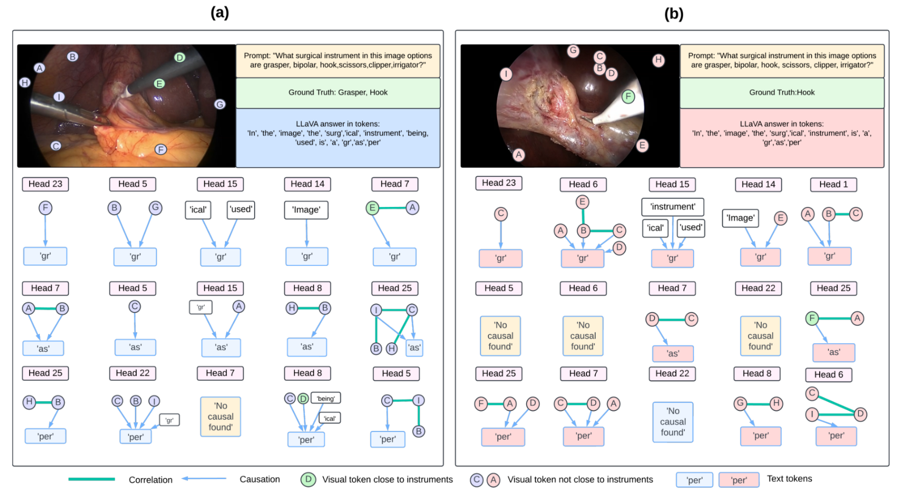 Grad-CAM and token-level causal graph