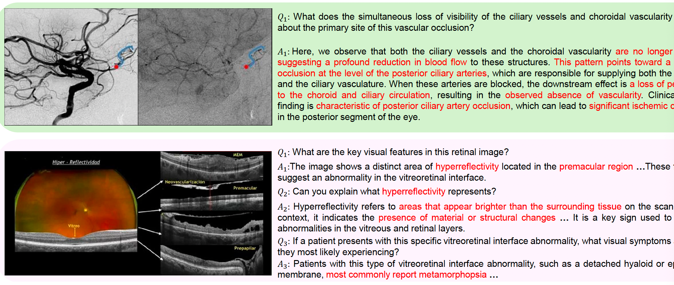 OphIn-500K: CuratingWeb-Scale Visual Instructions for Scaling Ophthalmic Multimodal Large Language Models