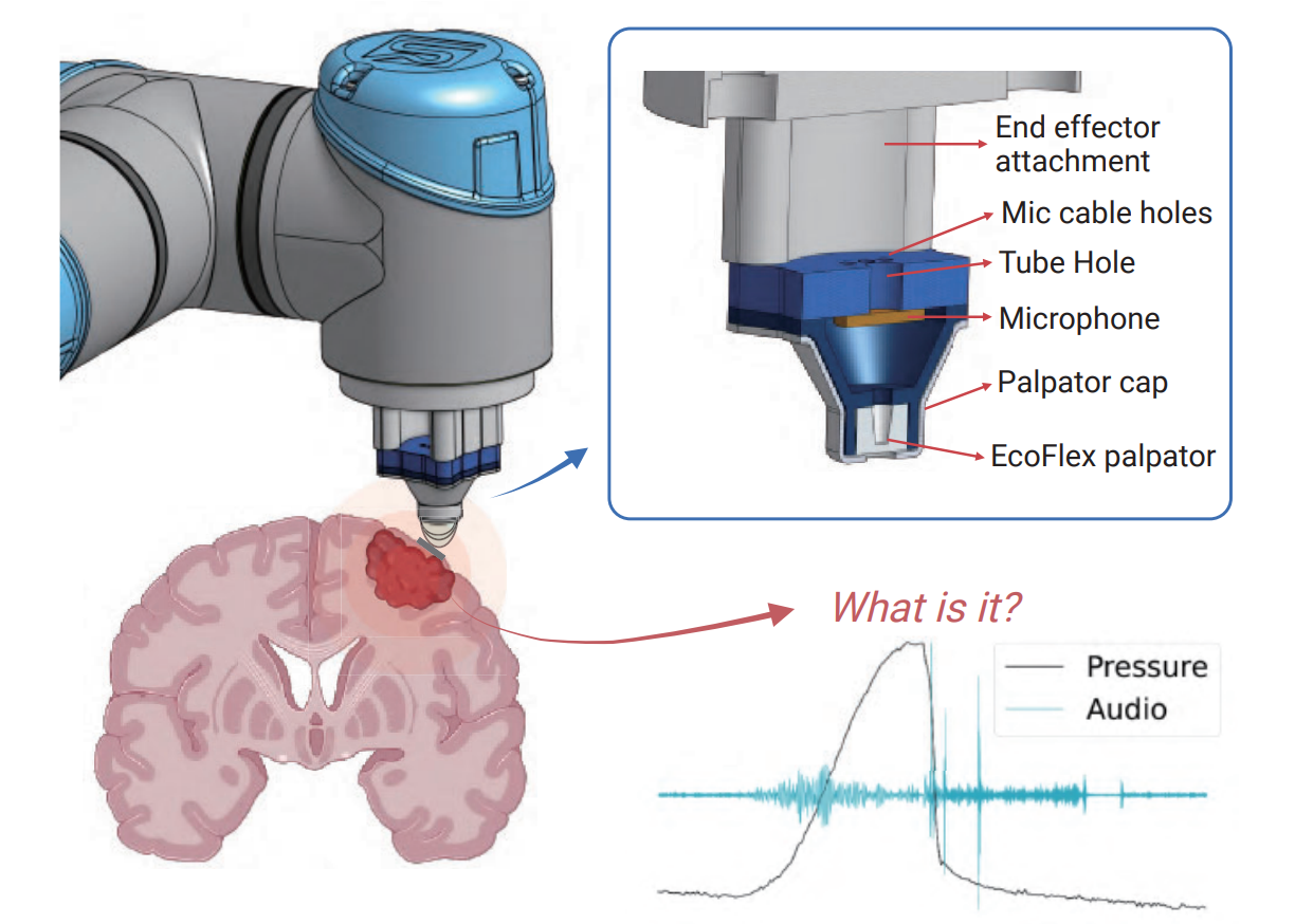 PalpAid: Multimodal Pneumatic Tactile Sensor for Tissue Palpation