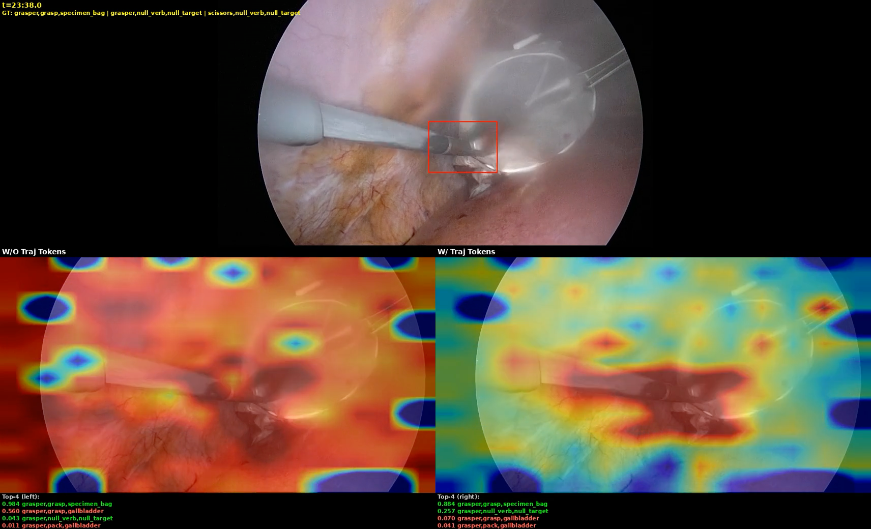 TrajPred: Trajectory-Conditioned Joint Embedding Prediction for Surgical Instrument-Tissue Interaction Recognition in Vision-Language Models